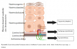 Epidermolysis bullosa - klasyfikacja